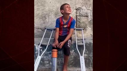 Bir lokma sevinç, bir ömürlük acı: Gazze’de bir çocuk, kendi protezini yaptı
