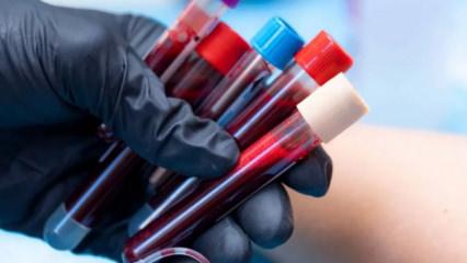 En zeki insanlar bu kan grubuna sahip! Zekanızı belirleyebilir mi?