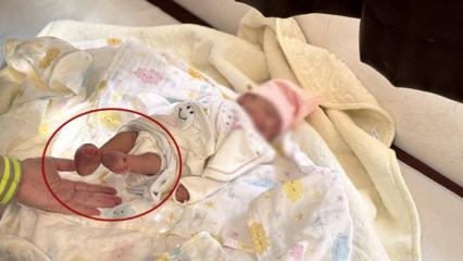 Elsiz ve ayaksız doğacaktı! Anne karnında müdahale