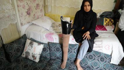 Depremde bacağını kaybeden kadın kocası tarafından terk edildiğini iddia etti