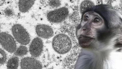 'Hastalıklı maymunlar' alarma geçirdi! ABD'de tuhaf olay!