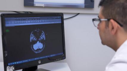 İnme, her yaşta görülebilir: İlk 24 saat hayati önem taşıyor