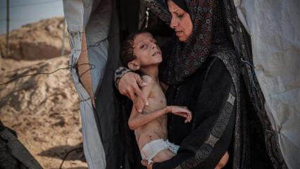 İsrail'in yeni savaş politikası: Gazze halkını silahla değil açlıkla yok ediyor