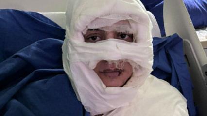  Kadıköy'de akıl almaz olay: Genç kadın başka bir kadın tarafından ateşe verildi