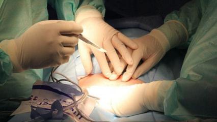 Anneler canlı organ naklinde ilk g&ouml;n&uuml;ll&uuml; don&ouml;r oluyor