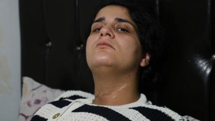 Cips paketini açarken boğazını kesti! Ayrıldığı eşi dehşeti yaşattı: Ölmedin mi sen?