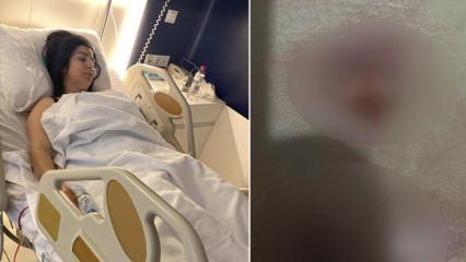 Yağ aldırma ameliyatı kabusa döndü: Ses sanatçısı hastane ile mahkemelik oldu