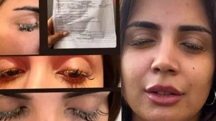 Kirpik yaptırmak isteyen kadının hayatı kabusa d&ouml;nd&uuml;: K&ouml;r olacaktı!