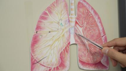 KOAH ölüm listesinde 3. sıraya yerleşti: Risk kış aylarında daha da artıyor!