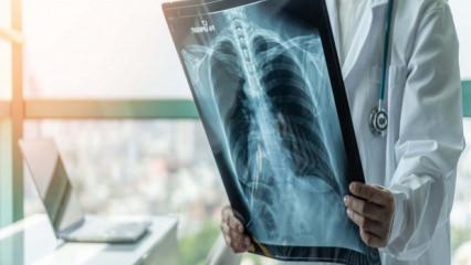 Prof. Dr. Şener 'süperenfeksiyon' için uyardı: ‘Dikkat etmek lazım, ücretsiz aşınızı olun