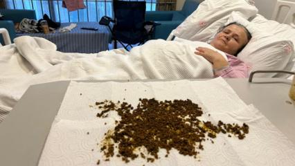 Doktorlar şoke eden vaka: Safra kesesinden 20 binin üzerinde taş çıktı! İşte o görüntü...