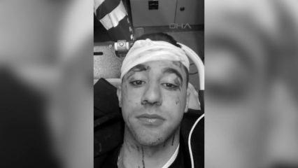 Taksici ile motosiklet s&uuml;r&uuml;c&uuml;s&uuml; kavgasında kan aktı