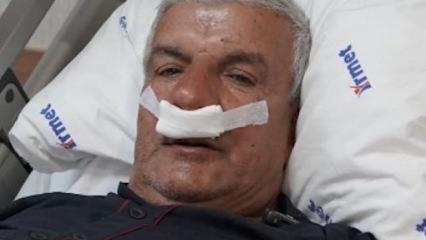 27 yıllık mesleğin şaşırtan sonucu: Burnundan 100 gramlık taş çıktı 