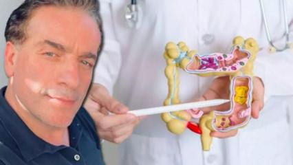 Murat Cemcir'i yoğun bakımlık eden hastalık divertikül kanaması nedir?