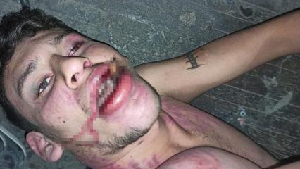 Antalya'da hamam b&ouml;ceği yedirilen gencin dosyasında karar verildi