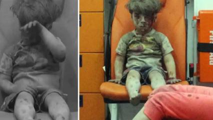 Dünya gündemine oturmuştu! Ümran bebeğin son hali ortaya çıktı!