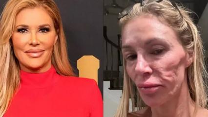 Ünlü yıldızın yüzü resmen eriyip şekil değiştirdi