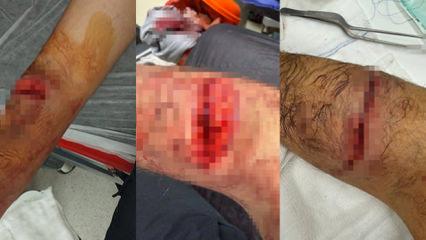 Başakşehir'de sahipli köpek dehşeti! Site güvenliği hastanelik oldu