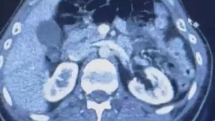 Üç İranlı röntgene girince yakayı ele verdi