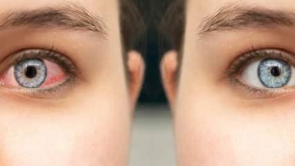 Uzmanı uyarıyor: Kış aylarında soğuk hava ve kapalı ortamlar, göz sağlığını tehdit ediyor!