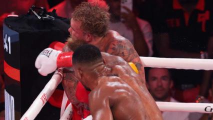 Fenomen boks&ouml;r&uuml;n &ccedil;enesi iki yerden kırılmış: Titanyum plak takıldı