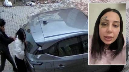 Kağıthane&rsquo;de boşanma aşamasındaki eşi tarafından sokak ortasında darbedilen kadın konuştu