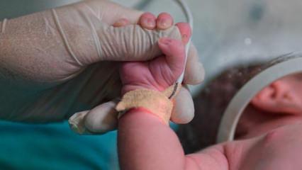 Yenidoğan tanı ve tedavisinde yapay zeka devreye girdi!