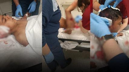 Ankara'da k&ouml;pek dehşeti: 8 yaşındaki Davut yaralandı