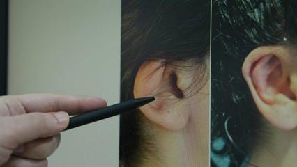 Uzman isim aileleri uyardı: Kep&ccedil;e kulak &ouml;zg&uuml;ven kaybına yol a&ccedil;abiliyor