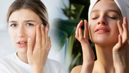 Cildiniz neme doysun: Kış aylarında cilt bakımı nasıl olmalı?