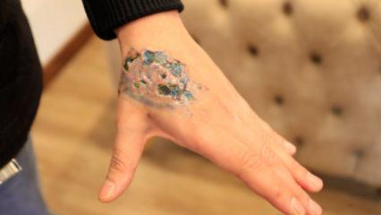 D&ouml;vme sildirmek istediği g&uuml;zellik merkezinden skandal &ouml;neri: Ağrın varsa ila&ccedil; al