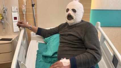 'Kalorifer kazanı' faciası: Y&uuml;z&uuml; tamamen yandı!