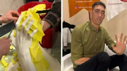 "D&uuml;nyanın en uzun adamı" Sultan K&ouml;sen'in ellerinin kalıbı alındı!