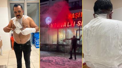 Sivas'ta soğuk hava deneyi hastanede bitti: Meşhur tost&ccedil;u kendini yaktı