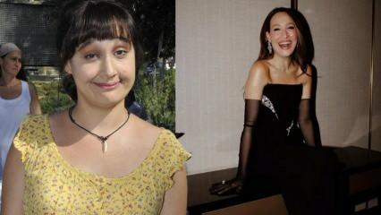 Gupse &Ouml;zay'ın hastalığı g&uuml;ndem oldu! Hızlı kilo kaybınızın sebebi &uuml;lseratif kolit olabilir