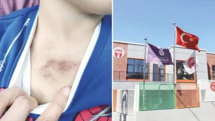 İBB kreşinde kan donduran iddia: 3 yaşındaki &ccedil;ocuğa taciz ve işkence