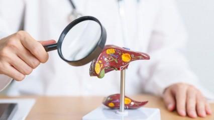 Tehdit artık uzakta değil: T&uuml;rkiye'de 10 yıl i&ccedil;inde 400 bin kişi siroz riskiyle karşı karşıya!