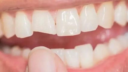 Siz de uzak durun: Dişlerinizi sinsice eritiyor, b&uuml;y&uuml;k zarar veriyor!