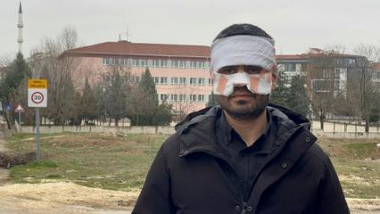 Okulda korku dolu anlar! Eskişehir'de &ouml;ğretmen meslektaşının y&uuml;z&uuml;n&uuml; yaktı iddiası