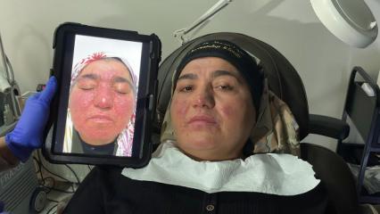 Hastalığı nedeniyle yıllarca evden &ccedil;ıkamayan kadın: Oğlumun d&uuml;ğ&uuml;n&uuml;ne gidemedim