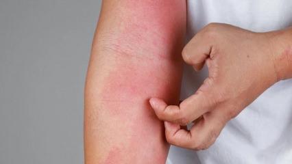 İstanbul'da kuduz iddiası! Valilikten a&ccedil;ıklama geldi