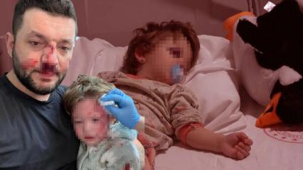Baba ile 14 aylık bebeğin darbedildiği olayın g&ouml;r&uuml;nt&uuml;leri ortaya &ccedil;ıktı