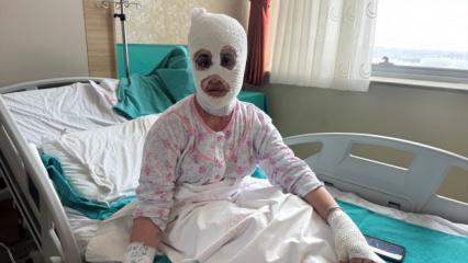 İftar hazırlığında facia: D&uuml;d&uuml;kl&uuml; tencere y&uuml;z&uuml;ne patladı!