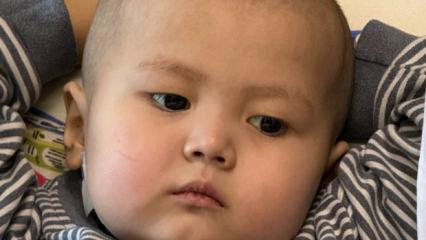 3 yaşındaki Nuryiğit, karaciğer nakliyle hayata tutundu