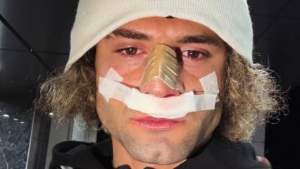 2. Lig'in gol kralının burnu kırıldı! Ma&ccedil;ı bu şekilde tamamladı