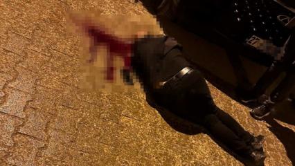 Korkun&ccedil; olay! Sokakta y&uuml;r&uuml;rken başından vuruldu