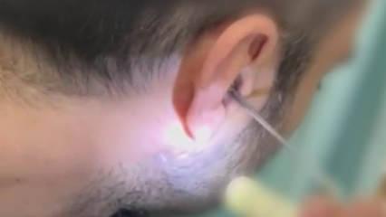 Kayseri'de akılalmaz olay: Kulağına gizlediği uyuşturucuyla yakalandı