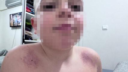 Antalya'da İlkokulda darp iddiası! Aile &ouml;ğretmenden şikayet&ccedil;i oldu