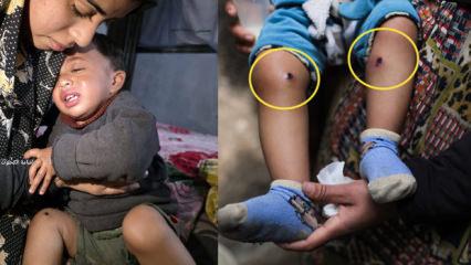 İsrail askerlerinden babayı itirafa zorlamak i&ccedil;in 1,5 yaşındaki bebeğe işkence