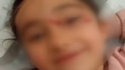 Yer: Ey&uuml;psultan! Okul d&ouml;n&uuml;ş&uuml; başıboş k&ouml;pek dehşeti: 6 yaşındaki &ccedil;ocuk hastanelik oldu